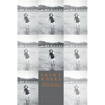 Skint Knees - Paperback / softback - 2015 - 1