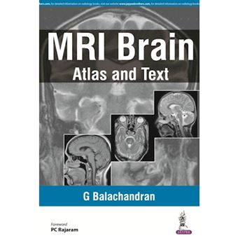 Mri Brain A Mini Atlas And Text - 1