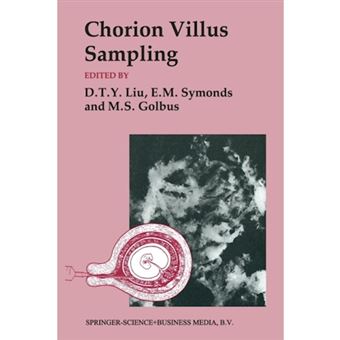 Chorion Villus Sampling - Paperback - 1987 - 1