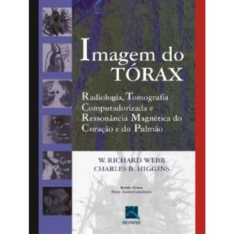 Imagem Do Tórax. Radiologia, Tc E Rm Do Coração E Do Pulmão - 1