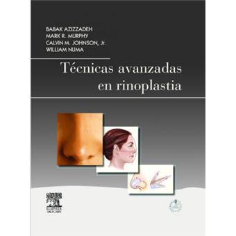 Técnicas avanzadas en rinoplastia - 1