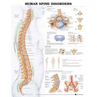Human Spine Disorders Anatomical Chart - 1