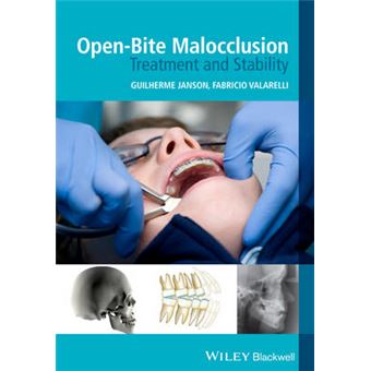 Open-Bite Malocclusion - Treatment and Stability - Paperback - 2013 - 1