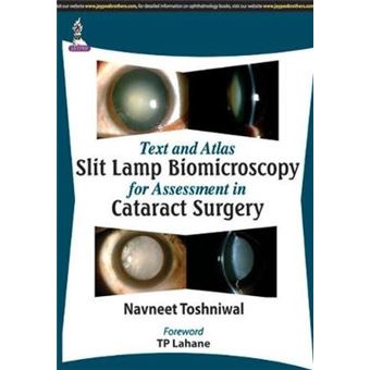 Text and Atlas: Slit Lamp Biomicroscopy for Assessment in Cataract Surgery - 1