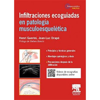 Infiltraciones ecoguiadas en patología musculoesquelética - 1