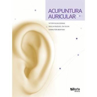 Acupuntura Auricular - 1