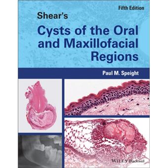 Shears Cysts Of The Oral And Maxillofacial Regions - 1