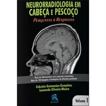 Neurorradiologia Em Cabeça E Pescoço. Perguntas E Respostas - Volume 1 - 1