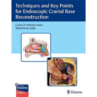 Techniques And Key Points For Endoscopic Cranial Base Reconstruction - 1