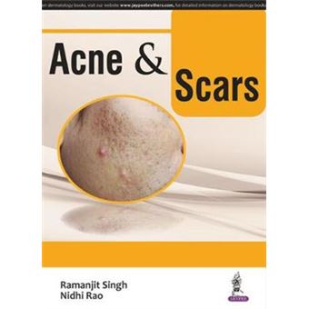 Acne & Scars - 1