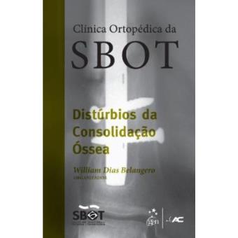 Distúrbios de Consolidação Óssea (SBOT) - 1