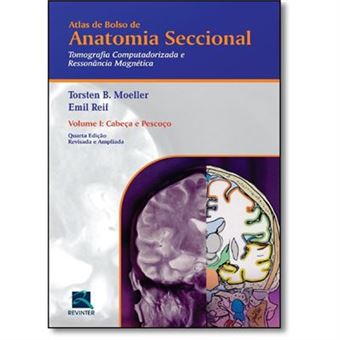 Anatomia Seccional Tomografia Computadorizada E Ressonância Magnética. Cabeça E Pescoço - Volume 1 - 1