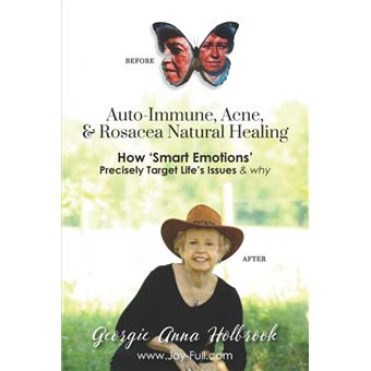 autoimmune, Acne, Rosacea Natural Healing How Smart Emotions Precisely Target Lifes Issues Why Paperback - - 1