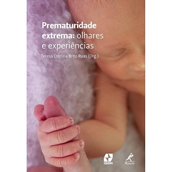 Prematuridade Extrema. Olhares e Experiências - 1
