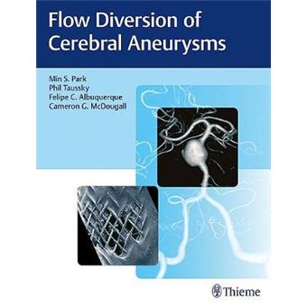 Flow Diversion Of Cerebral Aneurysms - 1