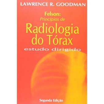 felson radiologia do torax felson radiologia do torax