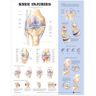Knee Injuries Anatomical Chart - Wallchart - 2001 - 1