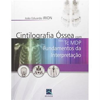 Cintilografia Óssea Com 99M Tc Mdp. Fundamentos Da Interpretação - 1
