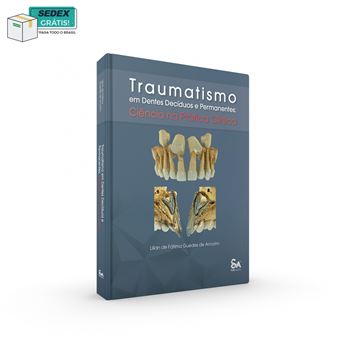 Traumatismo em Dentes Decíduos e Permanentes: Ciência na Prática Clínica - 1