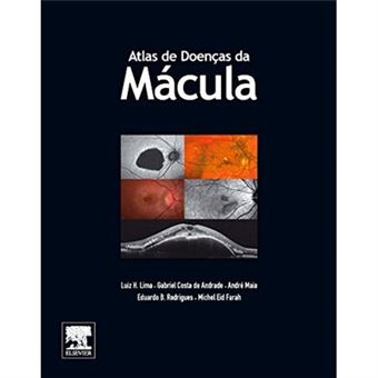 Atlas De Doenças Da Mácula - 1
