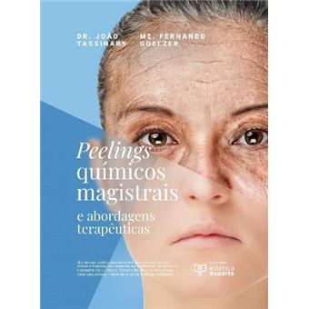 Peelings Quimicos Magistrais E Abordagens Terapeuticas - 1