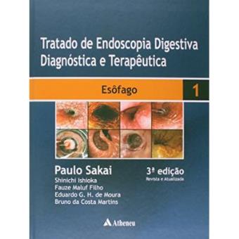 Esôfago. Tratado De Endoscopia Digestiva Diagnóstica E Terapêutica - Volume 1 - 1