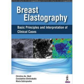 Breast Elastography Basic Principles And Interpretation Of Clinical Cases - 1
