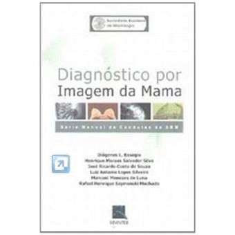 Diagnostico Por Imagem Da Mama - Série Manual De Condutas Sbm - 1
