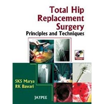 Total Hip Replacement Surgery : Principles and Techniques - 1