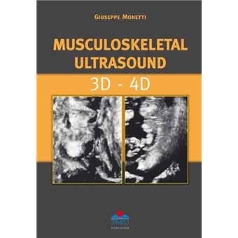 Musculoskeletal Ultrasound 3d - 4d - 1