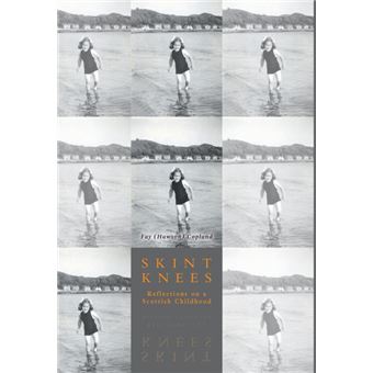 Skint Knees - Hardback - 2015 - 1