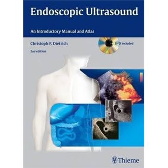 Endoscopic Ultrasound : An Introductory Manual and Atlas - 1