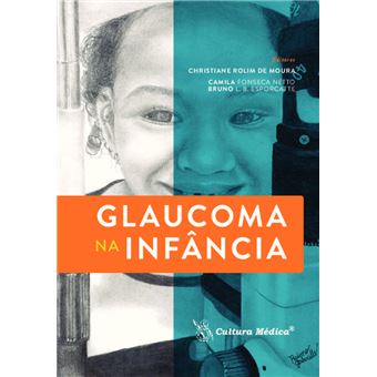 Glaucoma Na Infância - 1