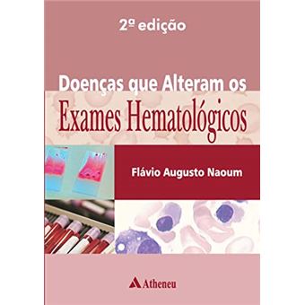 Doencas Que Alteram Os Exames Hematologicos - 2A E - 1