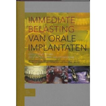 Immediate Belasting Van Orale Implantaten - Hardback - 2008 - 1