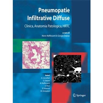 Pneumopatie Infiltrative Diffuse - Clinica, Anatomia Patologica, Hrtc - Paperback - 2005 - 1