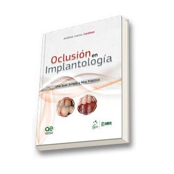 Oclusion En Implantologia - Una Guia Simple Y Muy Practica - 1