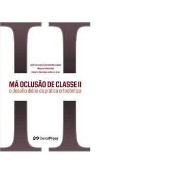 Má Oclusão de Classe Ii o Desafio Diário da Prática Ortodôntica - 1