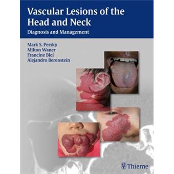 Vascular Lesions Of The Head And Neck Diagnosis And Management - 1