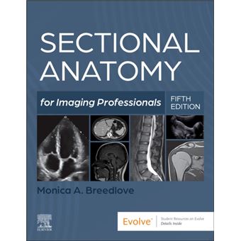 Sectional Anatomy for Imaging Professionals - 1
