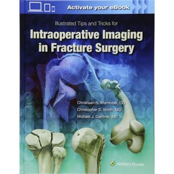 Illustrated Tips and Tricks for Intraoperative Imaging in Fracture Surgery - 1