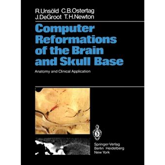 Computer Reformations of the Brain and Skull Base - Anatomy and Clinical Application - Paperback - 2011 - 1