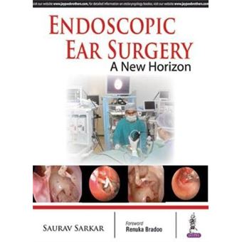 Endoscopic Ear Surgery A New Horizon - 1