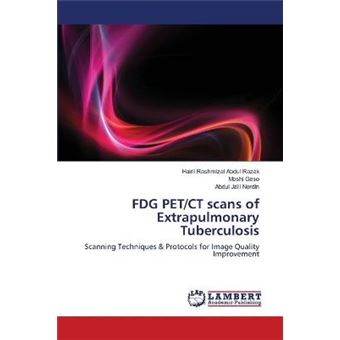 Fdg Pet/CT Scans of Extrapulmonary Tuberculosis - Paperback / softback - 2012 - 1