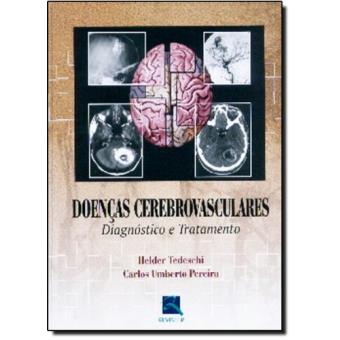 Doenças Cerebrovasculares. Diagnostico E Tratamento - 1