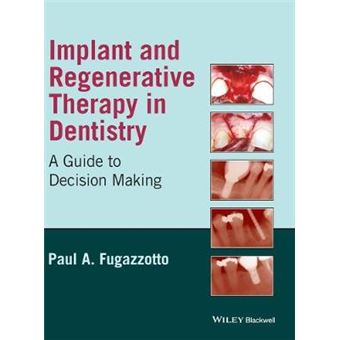 Implant and Regenerative Therapy in Dentistry - A Guide to Decision Making - Hardback - 2009 - 1