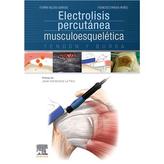 Electrolisis Percutánea Musculoesquelética. Tendón Y Bursa - 1