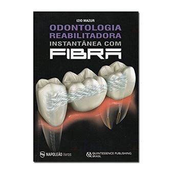 Odontologia Reabilitadora Instantânea com Fibra - 1