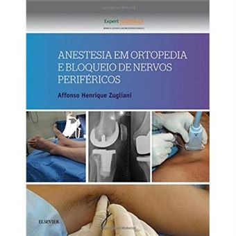 Anestesia Em Ortopedia E Bloqueio De Nervos Periféricos - 1