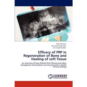 Efficacy of Prp in Regeneration of Bone and Healing of Soft Tissue - Paperback / softback - 2012 - 1